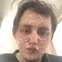 Artem